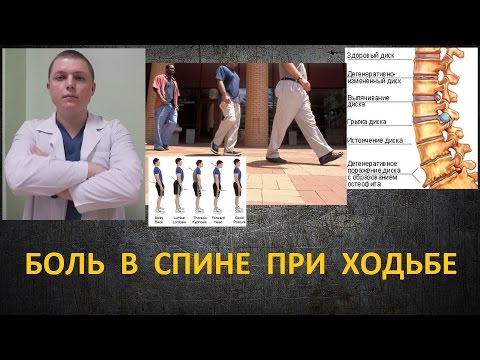 Болит спина сложно ходить Болит спина сложно ходить