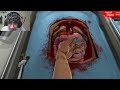 LE SIRINGHE NEGLI OCCHI!! - Surgeon Simulator 2013 - Parte 2