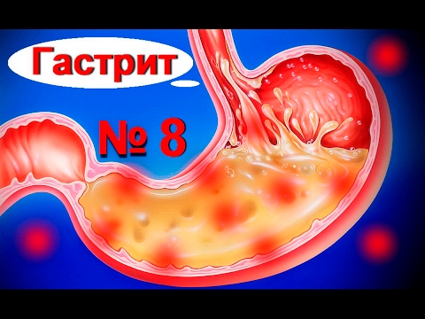 Лечение гастрита-чем лечить боли при гастрите 8 #лечениегастрита #edblack - YouTube