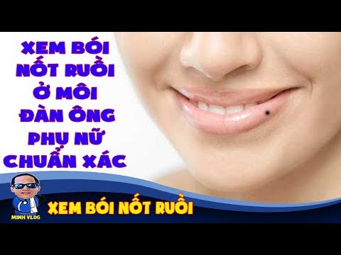 Xem bói nốt ruồi ở môi đàn ông, phụ nữ chuẩn xác | Xem bói nốt ruồi