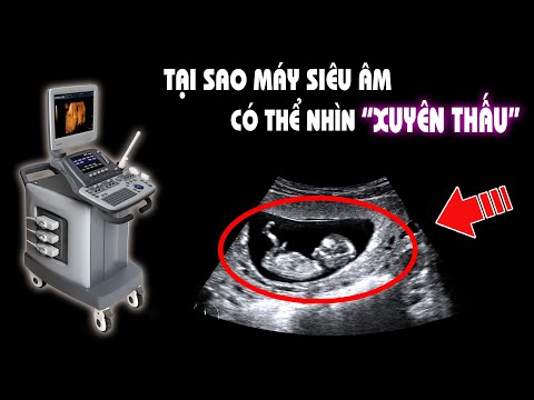 Máy siêu âm chụp ảnh "xuyên thấu" thế nào? Hiểu rõ trong 5 phút