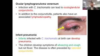 How Chlamydia Causes Clinical Complications Part 02