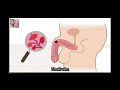 Hướng dẫn cách thủ dâm cho nam giới và nữ giới sướng nhất qua video
