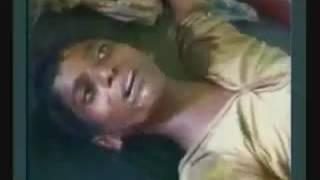 Rabies in India...