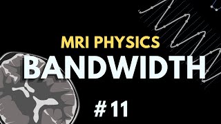 Mri Field Of View Fov, Matrix Size, Receiver Bandwidth, Dwell Time Mri Physics Course
