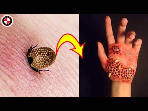Xuất Hiện Loài Côn Trùng Kinh Dị Có Vết Cắn Đáng Sợ Hơn Cả Hổ Mang Chúa