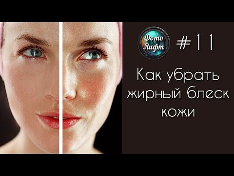 Как убирать жирность кожи Как убирать жирность кожи