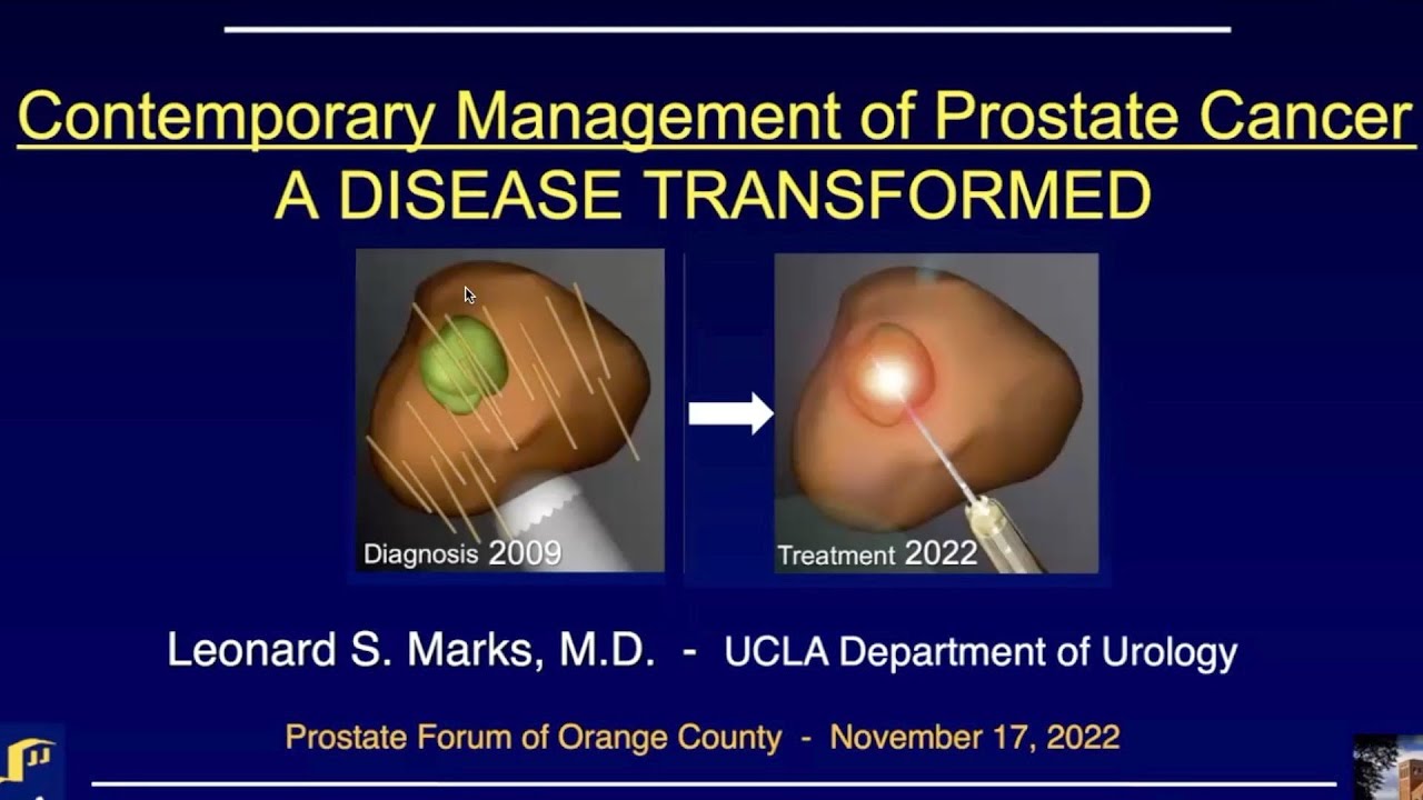 22-11. Prof. Leonard Marks MD. "Contemporary Management of Prostate Cancer"