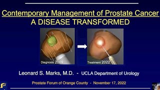 22-11. Prof. Leonard Marks MD. "Contemporary Management of Prostate Cancer"