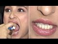 Parineeti Chopra Shows Off Her Dirty Yellow Teeth! OOPS SHE DID IT AGAIN…