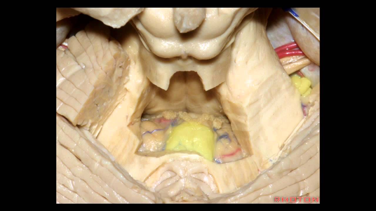 Cerebellopontine Angle and Fourth Ventricle - Part 1 of 2 - YouTube