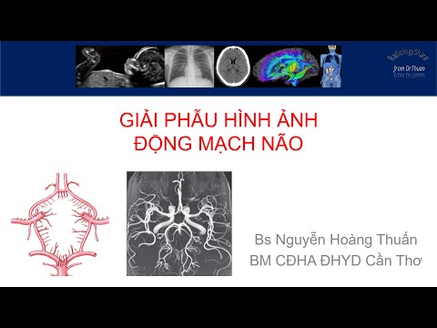 Giải phẫu hình ảnh động mạch não