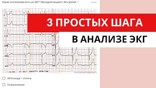 3 Простых Шага В Анализе Экг. Понятный Алгоритм Анализа Экг.