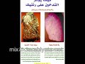 حملة ضد التدخين