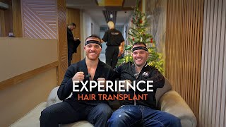 Gianluca Ve Robertonun Saç Ekimi Deneyimi, Processo Di Trapianto Di Capelli I Murat Makascı Klinik