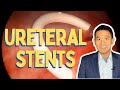 Ureteral Stent Insertion and Removal | Procedure in Detail