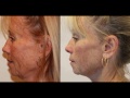 Anti Aging Skin Care Treatment NeriumAD Skincare