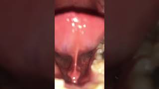 Hungry Kitten Eats You