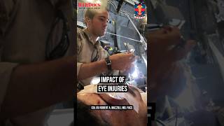 Impact Of Eye Injuries Col R Robert A. Mazzoli, Md, Facs