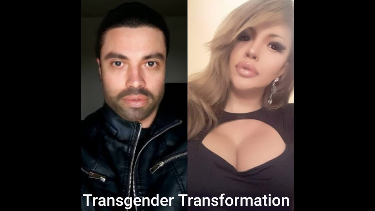 Transgender Life After Surgery
