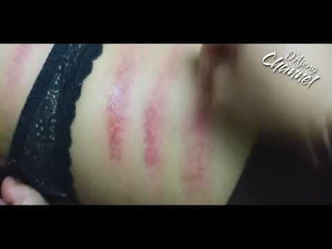 BACK SCRAPPING FOR BODY ACHES