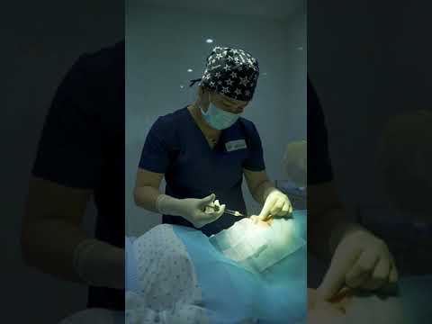 NÂNG MŨI KHÔNG PHẪU THUẬT - MŨI CAO TỨC THÌ CHỈ SAU 15 PHÚT