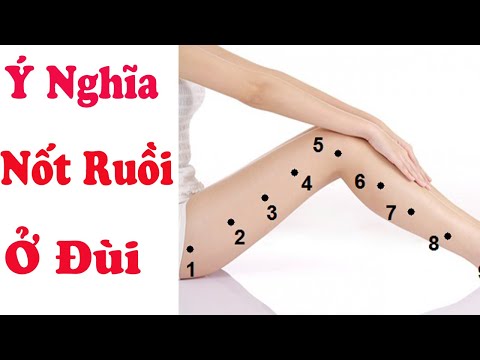 Ai Đang Sở Hữu Nốt Ruồi Ở Đùi Thì Đừng Bỏ Qua Bài Này -Xem Bói Nốt Ruồi Chuẩn nhất