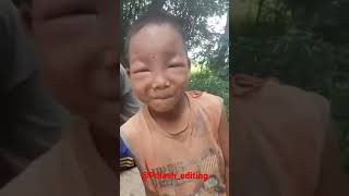 Borole kamurile kela🤣||see a small Assamese kid bitten by a bee🤣 funny moment