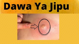 Njia Ya Kuondoa Majipu Hapo Nyumbani