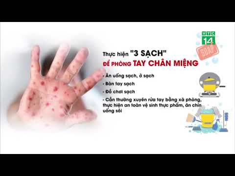Cách phát hiện sớm bệnh tay chân miệng | VTC14