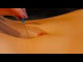 Needle bellybutton torture