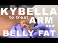 Kybella for Arm and Belly Fat - Dr. Paul Ruff | West End Plastic Surgery