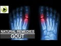 Aches & Pains - Gout - Natural Ayurvedic Home Remedies