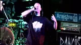 Watch Transplants One Seventeen video