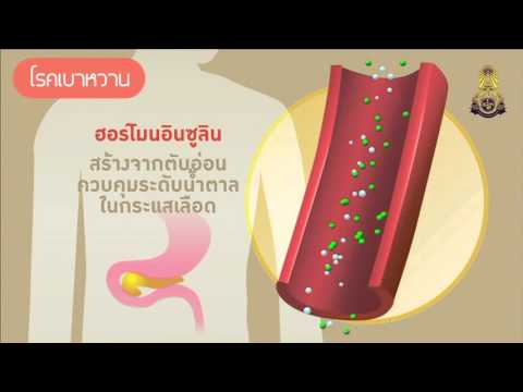 โรคเบาหวาน - ภาควิชาอายุรศาสตร์ วิทยาลัยแพทยศาสตร์พระมงกุฎเกล้า