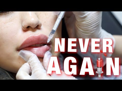 Permanent Necrosis... Video