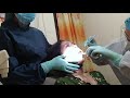 Painful Injection and Extraction Dentist Woman