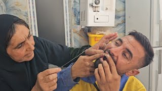 Hussains Attempt To Relieve Toothache With A Hot Iron Wire