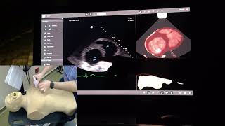 Echo Case - "can't breathe anymore", worsening dyspnea - Basic Echocardiogram - Dr Jamal USMLE