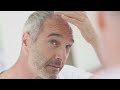 7 Formas De Detener La Caída Del Cabello En El Hombre