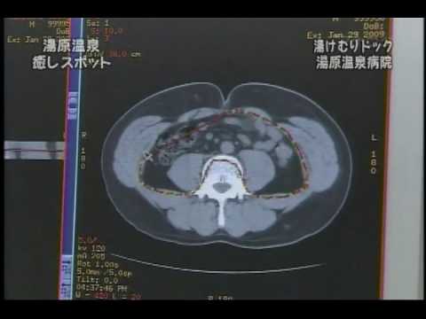 湯原温泉「癒しのスポット」：その３