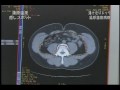 湯けむりドック:人間ドック付きの温泉宿泊プラン
