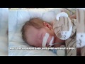 Inspirational: Baby Born With No Nose