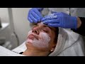 Microneedling with PRP (Platelet Rich Plasma)- Renee Tucker, Aesthetician | West End Plastic Surgery