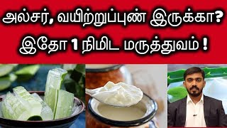 அலசர, இரபப பண எரசசல? இத 1நமட மரததவ கறபப Ulcer Easy Cure In 1 Minute Drsj