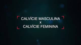 Transplante Capilar - Calvície Masculina X Calvície Feminina