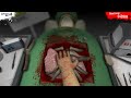 How to Save a Life...SUCCESS! (Surgery Simulator w/ Doctor Chilled) Part 3