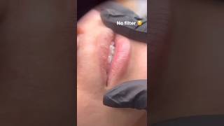 100% Effective Smooth Dry Chapped Lip Ournight With Just 3 Ingredients