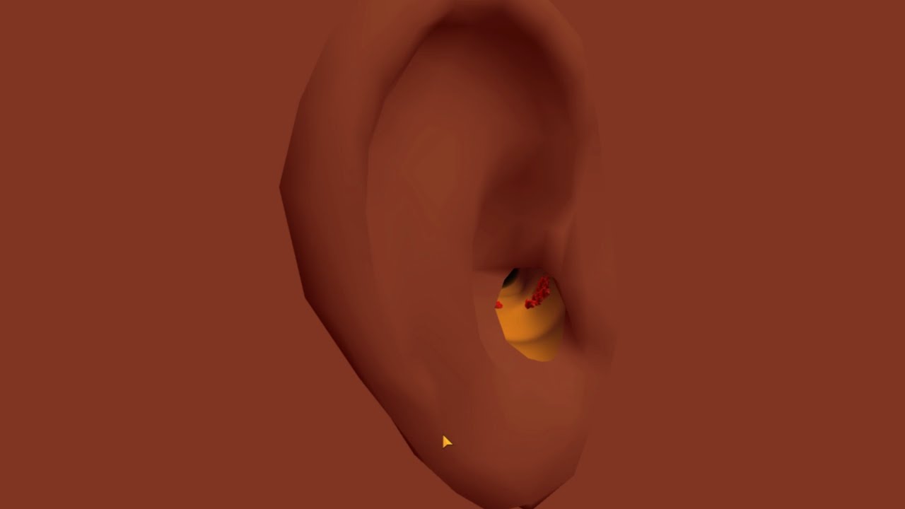 Earwaxclinic Gameplay All Levels iOS,Android Walkthrough Earwaxclinic Gameplay All Levels iOS,Android Walkthrough
