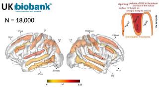 Genetic variations within human gained enhancer elements affect human brain sulcal morphology
